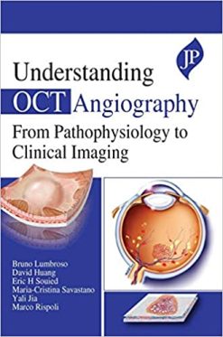 Understanding OCT Angiography from Pathophysiology to Clinical Imaging (Original PDF from Publisher)