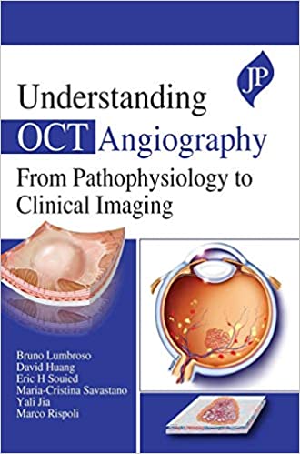 Understanding OCT Angiography from Pathophysiology to Clinical Imaging (Original PDF from Publisher)