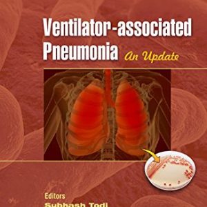 ECAB Clinical Update – Ventilator-associated Pneumonia – E-Book (Original PDF from Publisher)