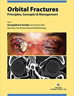 Orbital Fractures: Principles, Concepts & Managements (azw3+ePub+Converted PDF)