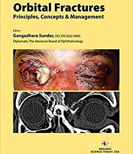 Orbital Fractures: Principles, Concepts & Managements (azw3+ePub+Converted PDF)
