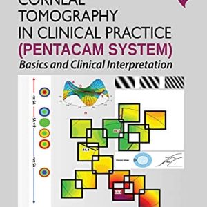 Corneal Tomography in Clinical Practice (Pentacam System): Basics and Clinical Interpretation, 4th Edition (Original PDF from Publisher)