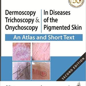 Dermoscopy, Trichoscopy & Onychoscopy In Diseases of the Pigmented Skin An Atlas and Short Text (Original PDF From Publisher)