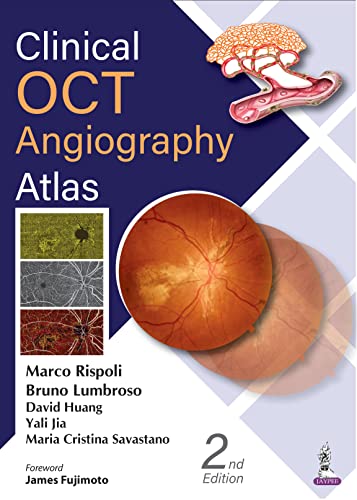 Clinical OCT Angiography Atlas, 2nd Edition (Original PDF from Publisher)