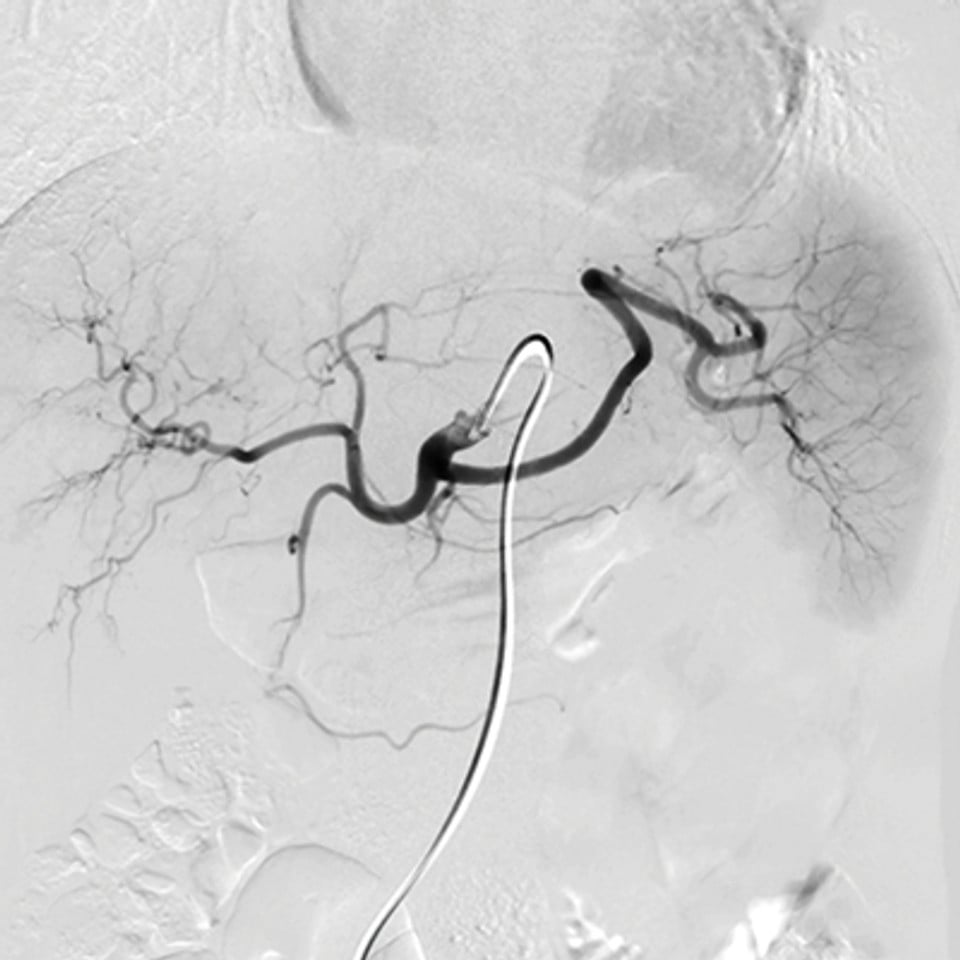 NYU Langone Vascular and Interventional Radiology Review and Update 2023 (Videos)