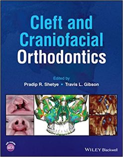 Cleft and Craniofacial Orthodontics (Original PDF from Publisher)