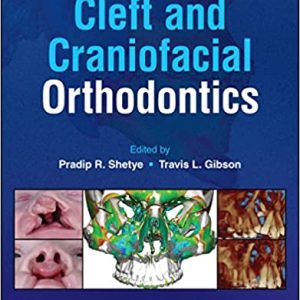 Cleft and Craniofacial Orthodontics (Original PDF from Publisher)