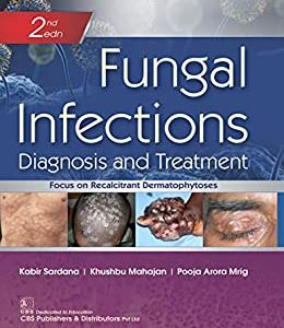 Fungal Infections Diagnosis and Treatment, 2nd edition (Original PDF from Publisher)