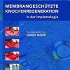 Membrangeschützte Knochenregeneration in der Implantologie (German Edition) (EPUB)
