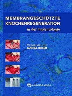 Membrangeschützte Knochenregeneration in der Implantologie (German Edition) (EPUB)