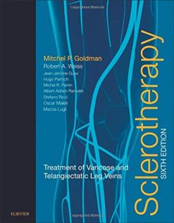 Sclerotherapy: Treatment of Varicose and Telangiectatic Leg Veins, 6th Edition (Original PDF from Publisher)