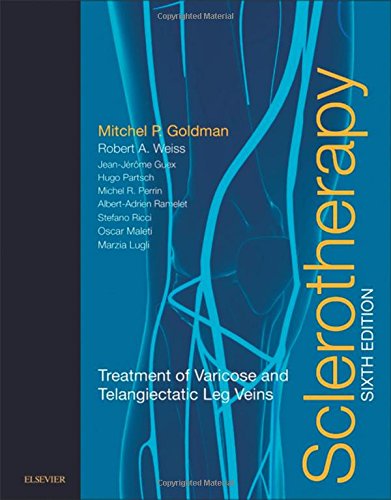 Sclerotherapy: Treatment of Varicose and Telangiectatic Leg Veins, 6th Edition (Original PDF from Publisher)