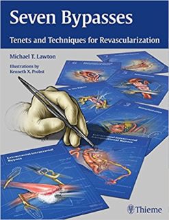 Seven Bypasses: Tenets and Techniques for Revascularization, 1st edition (Original PDF from Publisher)
