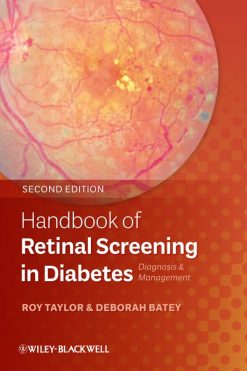 Handbook of Retinal Screening in Diabetes: Diagnosis and Management, 2ed (Original PDF from Publisher)