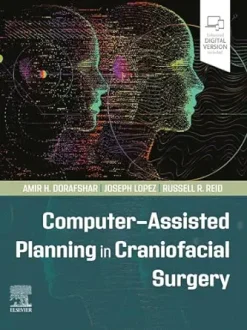 Computer-Assisted Planning in Craniofacial Surgery (ePub+Converted PDF+Videos)