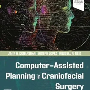 Computer-Assisted Planning in Craniofacial Surgery (ePub+Converted PDF+Videos)