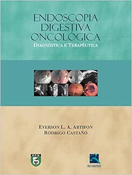 Endoscopia Digestiva Oncológica: Diagnóstico e Terapêutica, 1st Edition (EPUB)