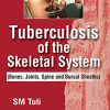 Tuberculosis Of The Skeletal System (Bones, Joints, Spine And Bursal Sheaths) (Original PDF from Publisher)