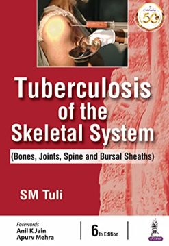 Tuberculosis Of The Skeletal System (Bones, Joints, Spine And Bursal Sheaths) (Original PDF from Publisher)