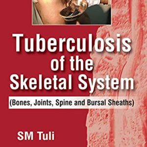 Tuberculosis Of The Skeletal System (Bones, Joints, Spine And Bursal Sheaths) (Original PDF from Publisher)