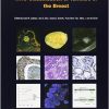 WHO Classification of Tumours of the Breast (IARC WHO Classification of Tumours) (Retail PDF)