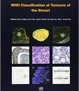 WHO Classification of Tumours of the Breast (IARC WHO Classification of Tumours) (Retail PDF)