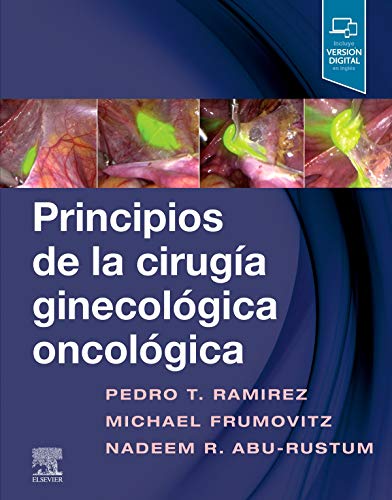 Principios de la cirugía ginecológica oncológica, 1e (Original PDF from Publisher)