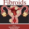 Fibroids (Original PDF from Publisher)