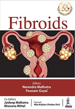 Fibroids (Original PDF from Publisher)