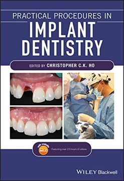 Practical Procedures in Implant Dentistry (Original PDF from Publisher)