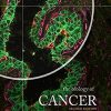 The Biology of Cancer, 2nd Edition (Original PDF from Publisher)