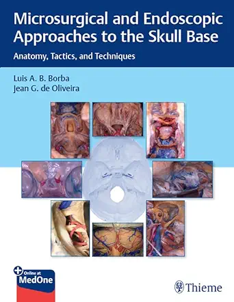 Microsurgical and Endoscopic Approaches to the Skull Base: Anatomy, Tactics, and Techniques (EPUB)