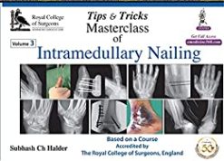 Tips & Tricks Masterclass Of Intramedullary Nailing (3 Volumes) (Original PDF from Publisher)