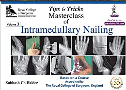 Tips & Tricks Masterclass Of Intramedullary Nailing (3 Volumes) (Original PDF from Publisher)