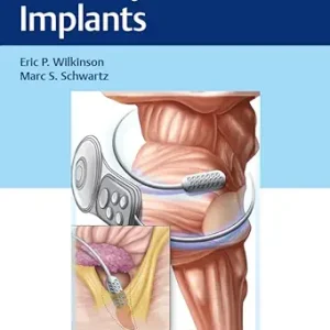 Auditory Brainstem Implants (EPUB)