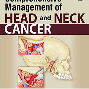 Comprehensive Management of Head and Neck Cancer (Original PDF from Publisher)