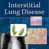 Interstitial Lung Disease, 5th Edition (Original PDF from Publisher)