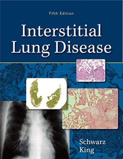 Interstitial Lung Disease, 5th Edition (Original PDF from Publisher)
