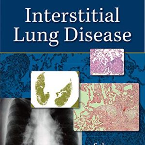 Interstitial Lung Disease, 5th Edition (Original PDF from Publisher)