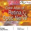 Color Atlas of Retina and Optic Nerve (Original PDF from Publisher)