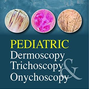 Pediatric Dermoscopy, Trichoscopy And Onychoscopy (Original PDF from Publisher)