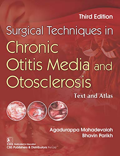 Surgical Techniques in Chronic Otitis Media and Otosclerosis: Text and Atlas (Original PDF From Publisher)