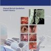 Transoral Laser Microsurgery of Benign and Malignant Lesions (EPUB)