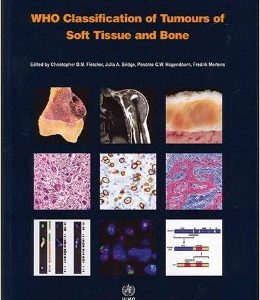 WHO Classification of Tumours of Soft Tissue and Bone (IARC WHO Classification of Tumours) (Retail PDF)