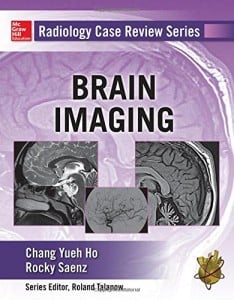 Radiology Case Review Series: Brain Imaging (EPUB)