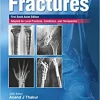 Handbook of fractures (First South Asia Edition) (Original PDF from Publisher)