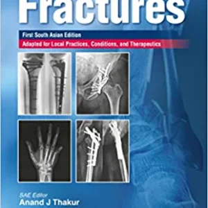 Handbook of fractures (First South Asia Edition) (Original PDF from Publisher)