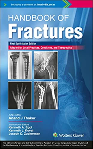 Handbook of fractures (First South Asia Edition) (Original PDF from Publisher)