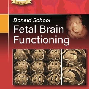 Donald School Fetal Brain Functioning (Original PDF from Publisher)
