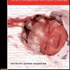Neonatal Seizures: Current Management and Future Challenges (Original PDF from Publisher)
